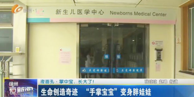 徐州婦幼保健院成功救治700克“掌中寶”引媒體爭相報道