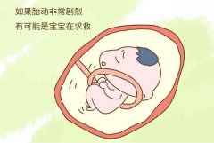 徐州市婦幼保健院產科朱錦明：媽媽要懂胎兒在肚子里的求救信號
