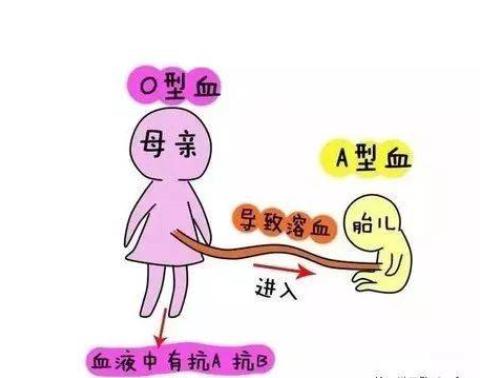 寶寶出生10個小時變黃，原來是患了“溶血病”