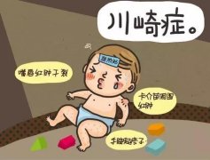 徐州市兒童醫(yī)院心血管專家：川崎病最明顯特征高燒不退、食欲不振