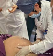 徐州市中心醫(yī)院產科外倒轉術 助臀位寶寶“華麗轉身” 成功順產